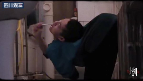 尚盈配资 世界首例！00后山东“折叠男孩”4次手术“打开”身体，现已能站直